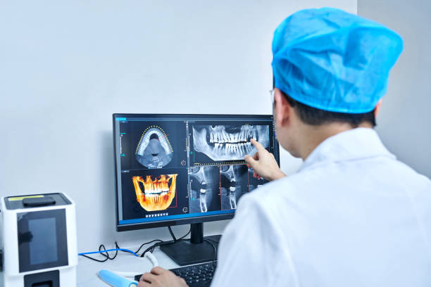 Best Emergency Wisdom Tooth Extraction in Lincoln, MO